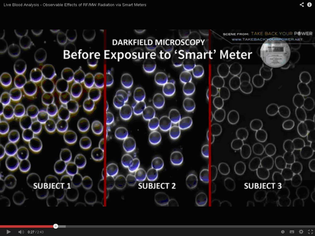 Red Blood Cells Before Small