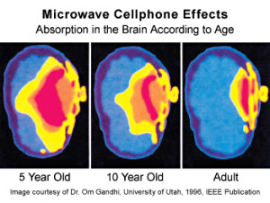 Brain Image cell phone